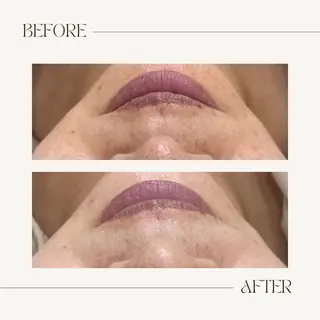 CEsalonEgg 齋藤のエステ・リラクイメージ