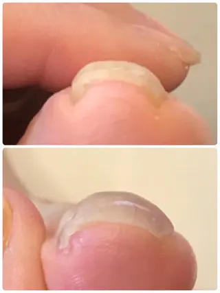 ネイル 冨澤 ひろみのネイルデザイン