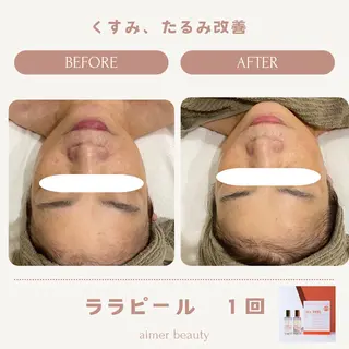 aimer beautyのエステ・リラクイメージ