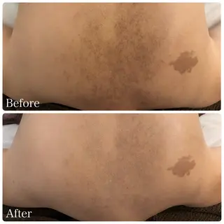 肌管理サロン Briller所属・肌管理サロン Briller 押上のエステ・リラクイメージ