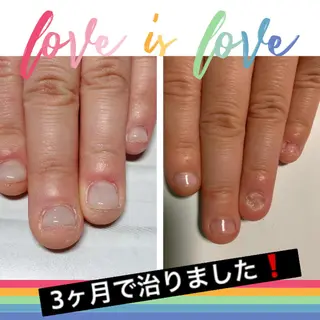 ネイル ネイルサロン HARRYS所属・ネイル･脱毛サロン HARRYSのエステ・リラクイメージ