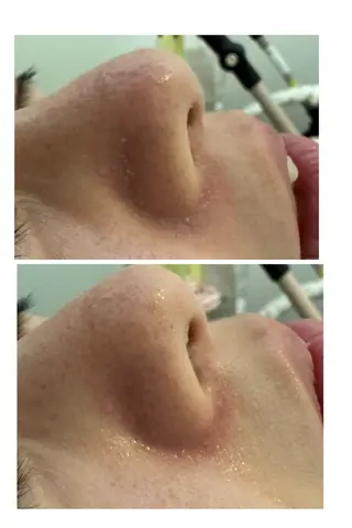 ナリスビューティサロンあべの所属・肌質改善/ツヤ肌作り /松本杏奈のエステ・リラクイメージ