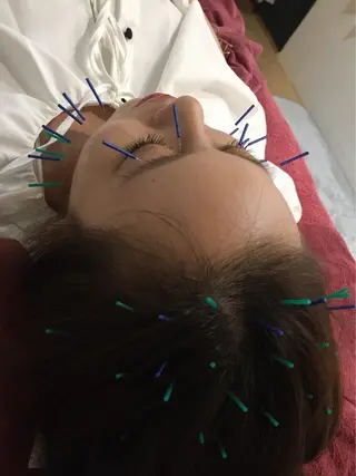 美容鍼灸女性専用 りんご鍼灸治療院のエステ・リラクイメージ