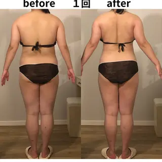 小顔・痩身専門店 Sunao所属・小顔.足痩せ整体 痩身天六Sunaoのその他イメージ