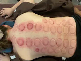 美楽鍼 びらくしんのその他イメージ