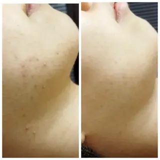 若返り 美肌   エステサロンららんのエステ・リラクイメージ