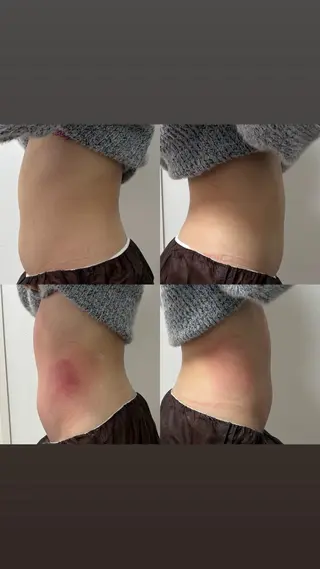 Miiju.所属・石巻 冷却痩身 Miiju. 鈴木のエステ・リラクイメージ