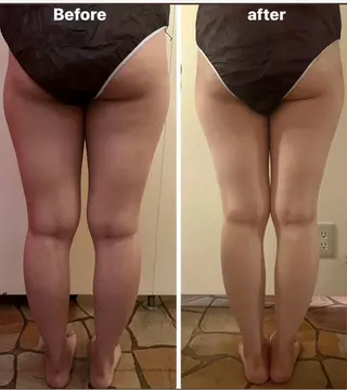 blossom山内店 (ブロッサム山内店)所属・la　salon. chihoriのエステ・リラクイメージ