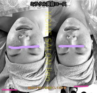 HOME SALON linoのエステ・リラクイメージ