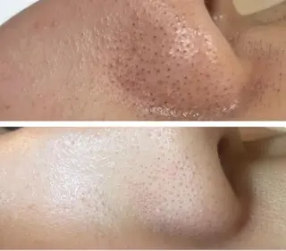 エステティックレイ ビス秋田店　菅野のエステ・リラクイメージ