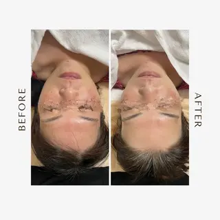 東海エリア1位受賞 長江香保のエステ・リラクイメージ