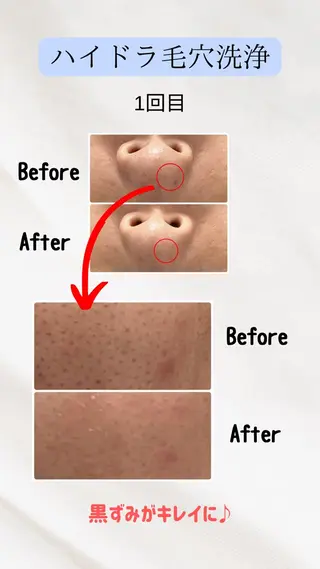 Mon Lapin所属・Mon Lapin 〜モン　ラパン〜のエステ・リラクイメージ