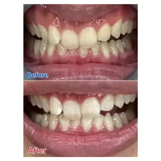 M渋谷店所属・M渋谷 ホワイトニングのエステ・リラクイメージ