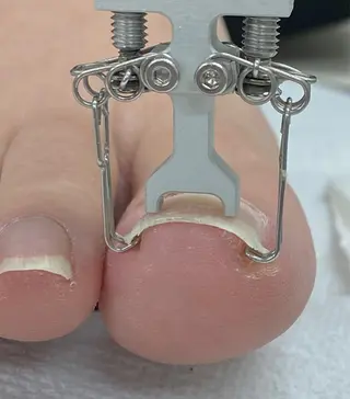 ネイル プライベートサロン Rのネイルデザイン