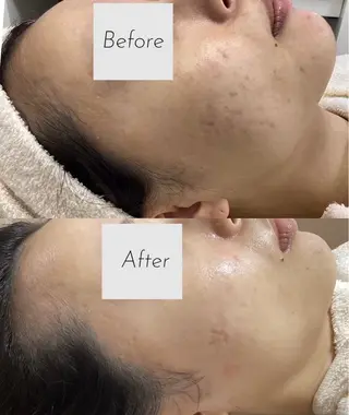 都度払い 肌質改善専門サロンのエステ・リラクイメージ