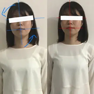 顔の歪み矯正専門 宮内翔のエステ・リラクイメージ