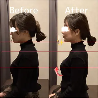 Body Loop メディカル整体院 梅田所属・肩こり腰痛/根本改善 田中愛奈のエステ・リラクイメージ