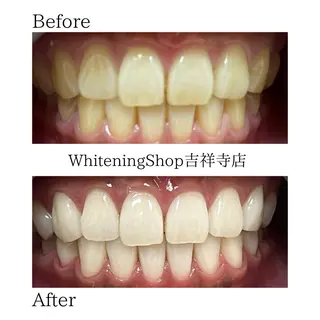 ホワイトニング ショップ吉祥寺店のエステ・リラクイメージ