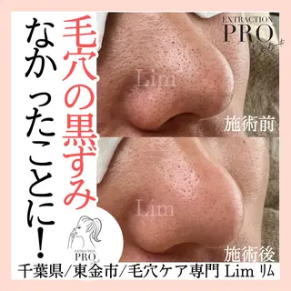 Lim Naomiのマツエク・マツパデザイン