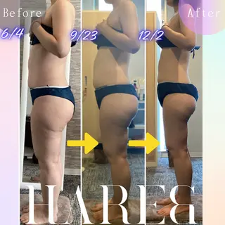 Hare&所属・川西エステサロン Hare&のエステ・リラクイメージ