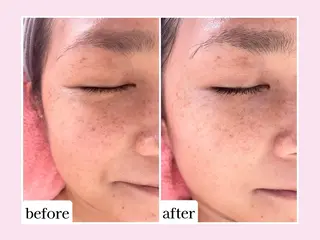 Karen Private Spa所属・💜Karen PrivateSpaのエステ・リラクイメージ