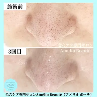 毛穴ケア専門サロン Amélio Beauté所属・毛穴ケア専門サロン アメリオボーテのその他イメージ