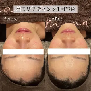 小顔美肌：ミアンカ 京阪モール本館1Fのエステ・リラクイメージ