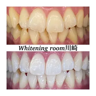 メンズ キッズ ホワイトニングルーム　川崎店所属・ホワイトニング ルーム　川崎店のその他イメージ