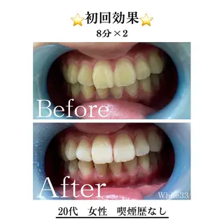 セルフホワイトニング White33大名のその他イメージ