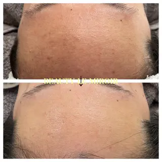 マツエク・マツパ ビューティー ミロワールのエステ・リラクイメージ