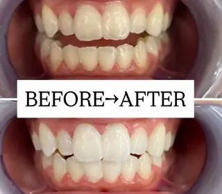 【歯科提携】歯のセルフホワイトニング専門店 セルフホワイトニングサロン宝塚所属・箕浦 乙葉のその他イメージ