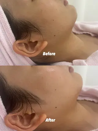 🫧美しい素肌へ🫧 今成柚乃のその他イメージ