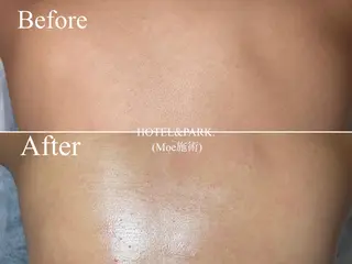 HOTEL&PARK . ワックス脱毛のエステ・リラクイメージ