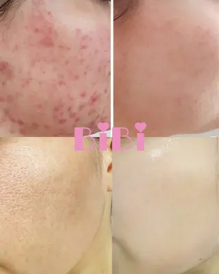 🎀BiBi韓国美容 コスパ強！美活サロンのエステ・リラクイメージ