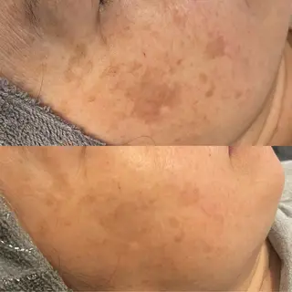 シミケア専門店モルセラ所属・シミケア専門店 モルセラのエステ・リラクイメージ