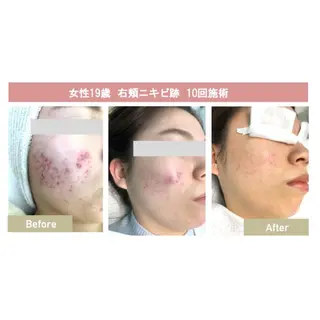 美肌脱毛i所属・美肌脱毛ｉ ｜泉大津のエステ・リラクイメージ