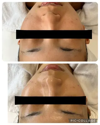 DeI'mあま所属・若返り❤️ エステサロン❤️のその他イメージ