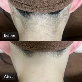 脱毛専門サロン BELFINE恵比寿のエステ・リラクイメージ