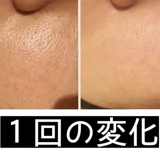 ミディアム カラー パーマ ヘアアレンジ メンズ キッズ ネイル マツエク・マツパ ニキビ・肌質改善専門 ♡人生が変わるサロンのエステ・リラクイメージ