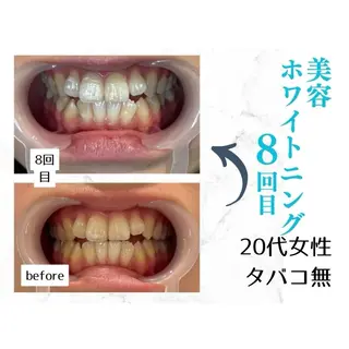 ホワイトニングサロン le  canonのその他イメージ