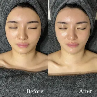 𝐌𝐚𝐜𝐡𝐞 𝐛𝐲 𝐌𝐚𝐲𝐮所属・ハーブピーリング🌿 𝑴𝒂𝒚𝒖のエステ・リラクイメージ