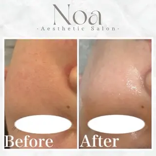 エステサロンNoa所属・肌質改善サロン Noaのエステ・リラクイメージ