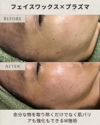 シミ毛穴|眉Wax THE flowのエステ・リラクイメージ