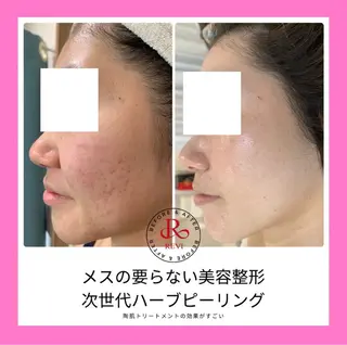 髪/まつげ/眉/毛穴 ハーブ/他/AIKOのその他イメージ