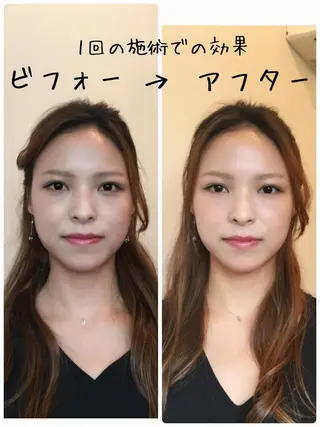 【パーソナル鍼灸】 Pintのエステ・リラクイメージ