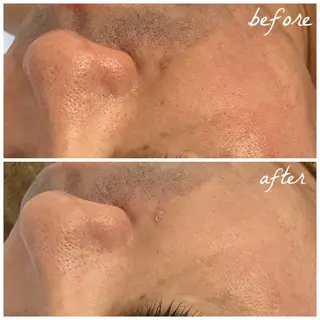 メンズ メナード岐阜市茜部 杉浦のエステ・リラクイメージ