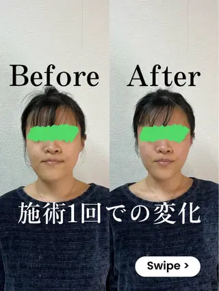 顔の整体 Nefert【ネフェルト】所属・こやま りょうのエステ・リラクイメージ