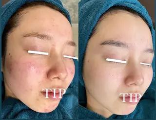 メンズ ソリッジ肌管理室所属・山村 有花のエステ・リラクイメージ