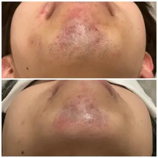 Tulipe 栄　八橋のマツエク・マツパデザイン