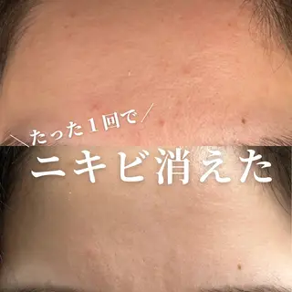 clé skin 🌿ハーブピーリングのエステ・リラクイメージ
